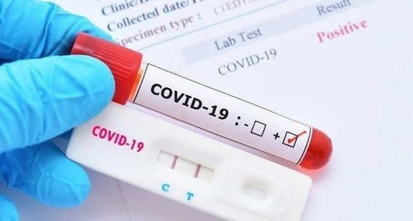 "Giới chủ" đứng sau hệ sinh thái doanh nghiệp chi hàng nghìn tỷ nhập khẩu kit test COVID-19
