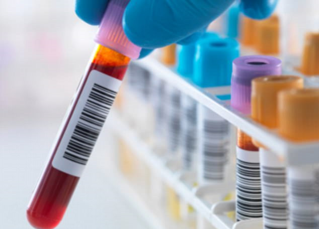 Mỹ phát triển phương pháp 'tiêu diệt' HIV tiềm ẩn trong tế bào