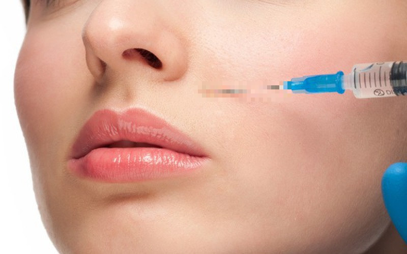 Người phụ nữ 27 tuổi mất thị lực sau tiêm filler làm đầy rãnh má ở tiệm tóc