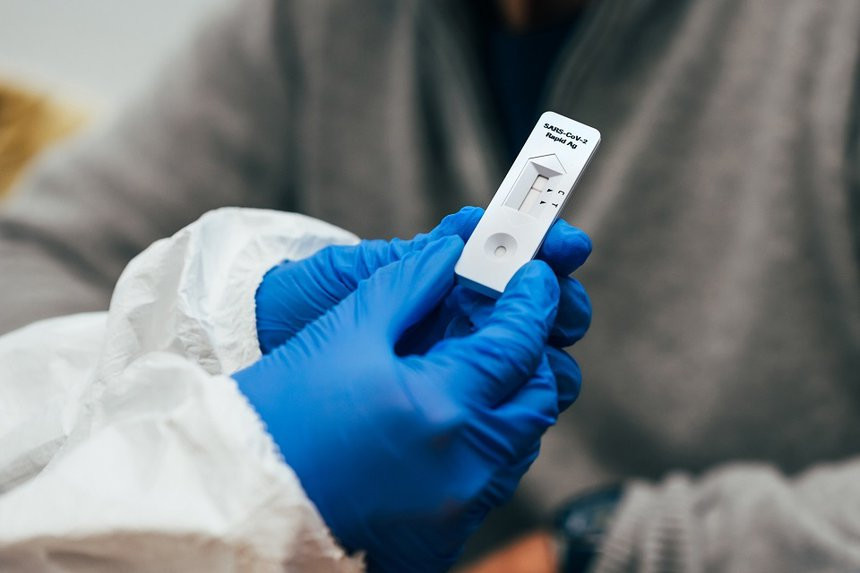 Có nên test nhanh COVID-19 ngay sau khi tiếp xúc với F0?